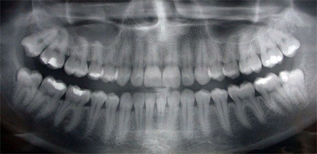 dental-xray.jpg